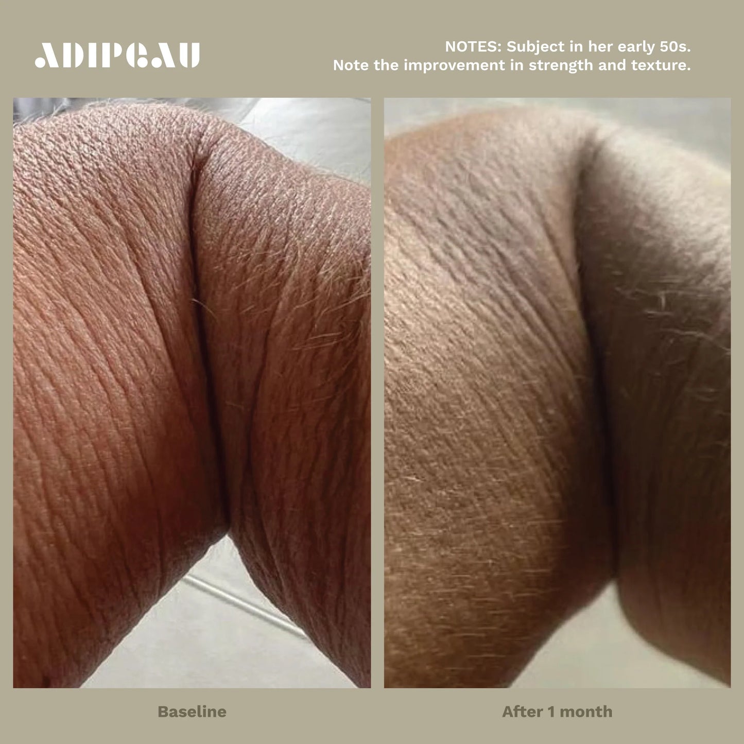Adipeau Strength Gel