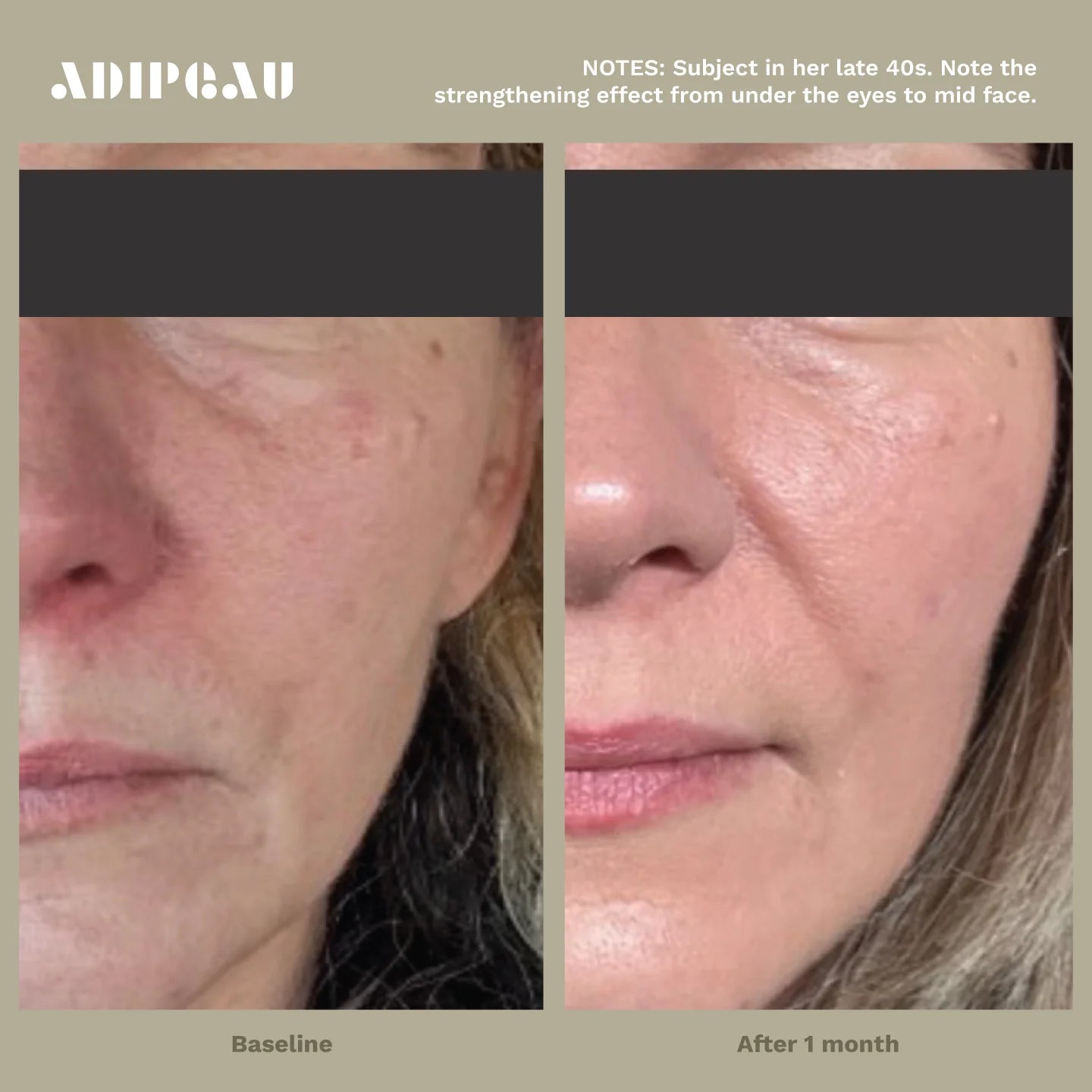 Adipeau Strength Gel