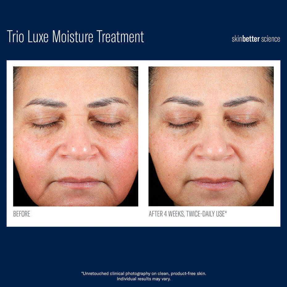 SkinBetter Science Trio Luxe Moisture Treatment