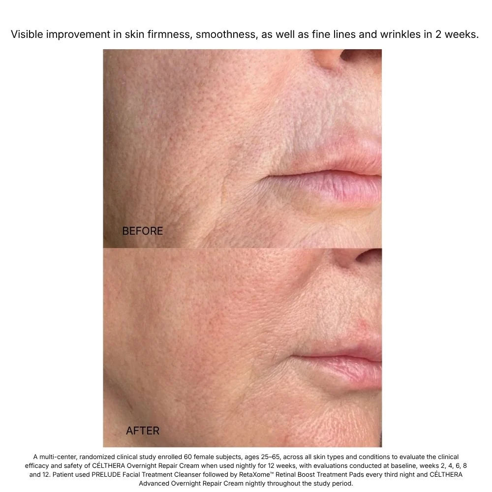 Hydrinity CELTHERA Advanced Overnight Repair Cream